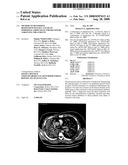 Method to determine responsiveness of cancer to epidermal growth factor receptor targeting treatments diagram and image