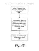 Bio-absorbable oil suspension diagram and image