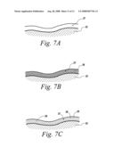 Bio-absorbable oil suspension diagram and image