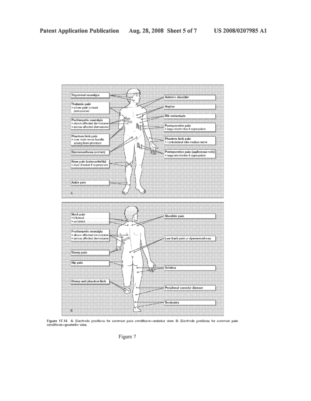 TRANSCUTANEOUS ELECTRICAL NERVE STIMULATION AND METHOD OF USING SAME - diagram, schematic, and image 06