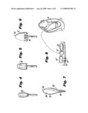 Heart assist device diagram and image