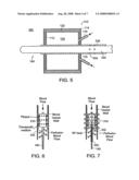 Device, systems and methods for localized heating of a vessel and/or in combination with mr/nmr imaging of the vessel and surrounding tissue diagram and image