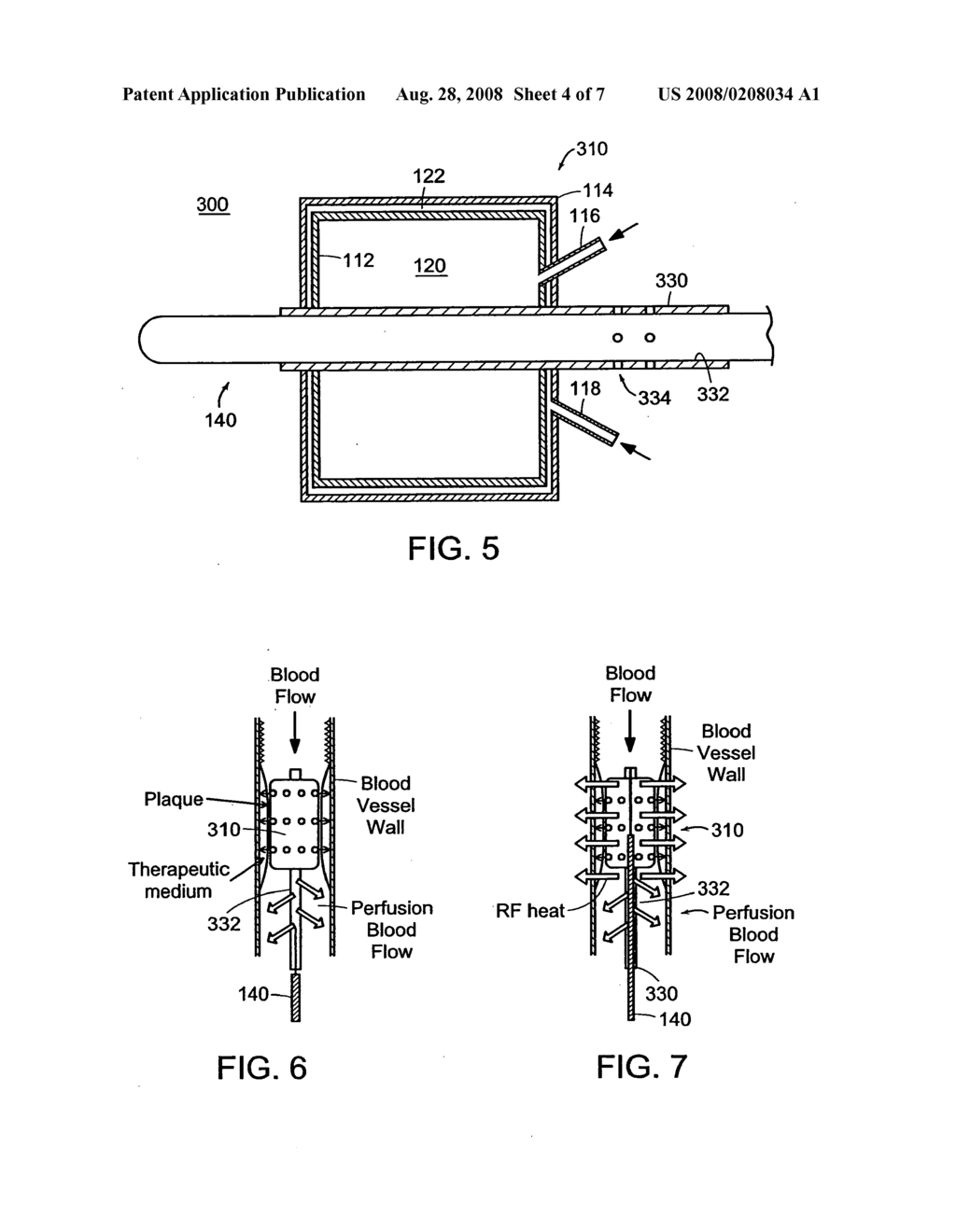 Device, systems and methods for localized heating of a vessel and/or in combination with mr/nmr imaging of the vessel and surrounding tissue - diagram, schematic, and image 05