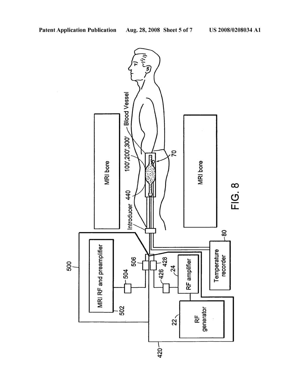 Device, systems and methods for localized heating of a vessel and/or in combination with mr/nmr imaging of the vessel and surrounding tissue - diagram, schematic, and image 06