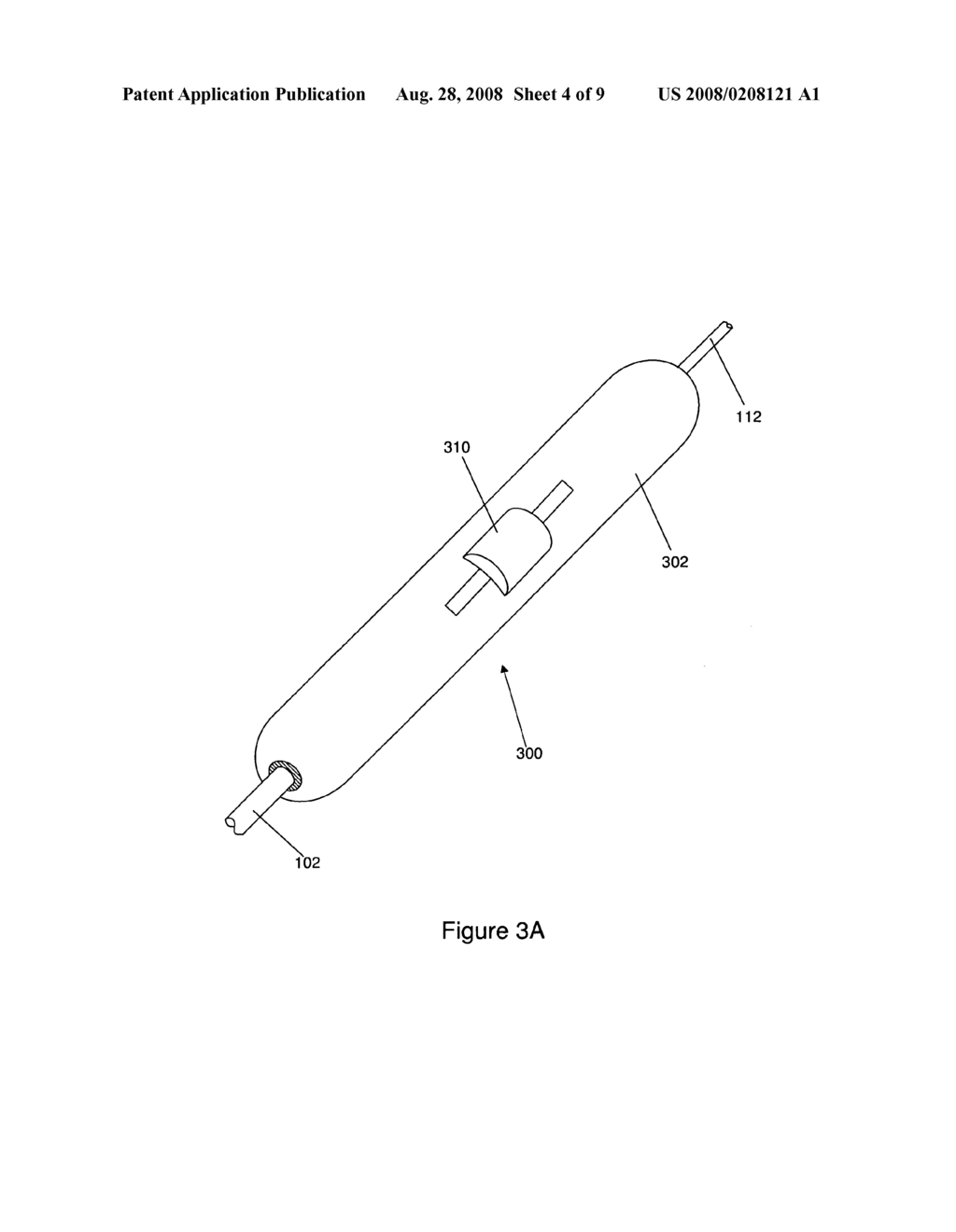 Method for creating a channel through a foreign material - diagram, schematic, and image 05