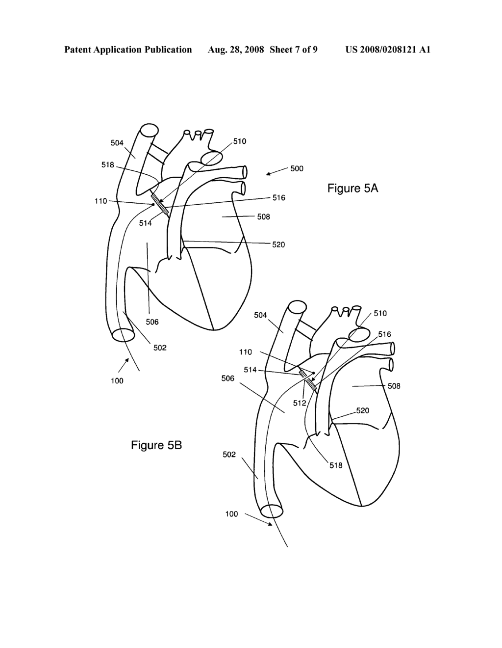 Method for creating a channel through a foreign material - diagram, schematic, and image 08