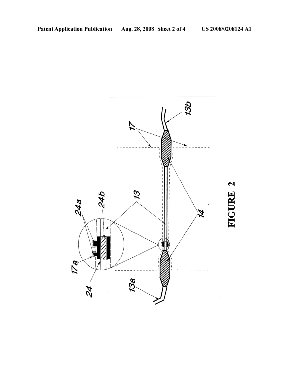 METHOD OF IDENTIFYING A FLOW SET FOR USE WITH A PUMP - diagram, schematic, and image 03