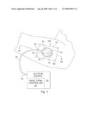 APPARATUS AND METHOD FOR WOUND TREATMENT EMPLOYING PERIODIC SUB-ATMOSPHERIC PRESSURE diagram and image