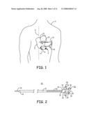 IMPLANTABLE MEDICAL DEVICE SYSTEM WITH FIXATION MEMBER diagram and image