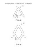 IMPLANTABLE MEDICAL DEVICE SYSTEM WITH FIXATION MEMBER diagram and image