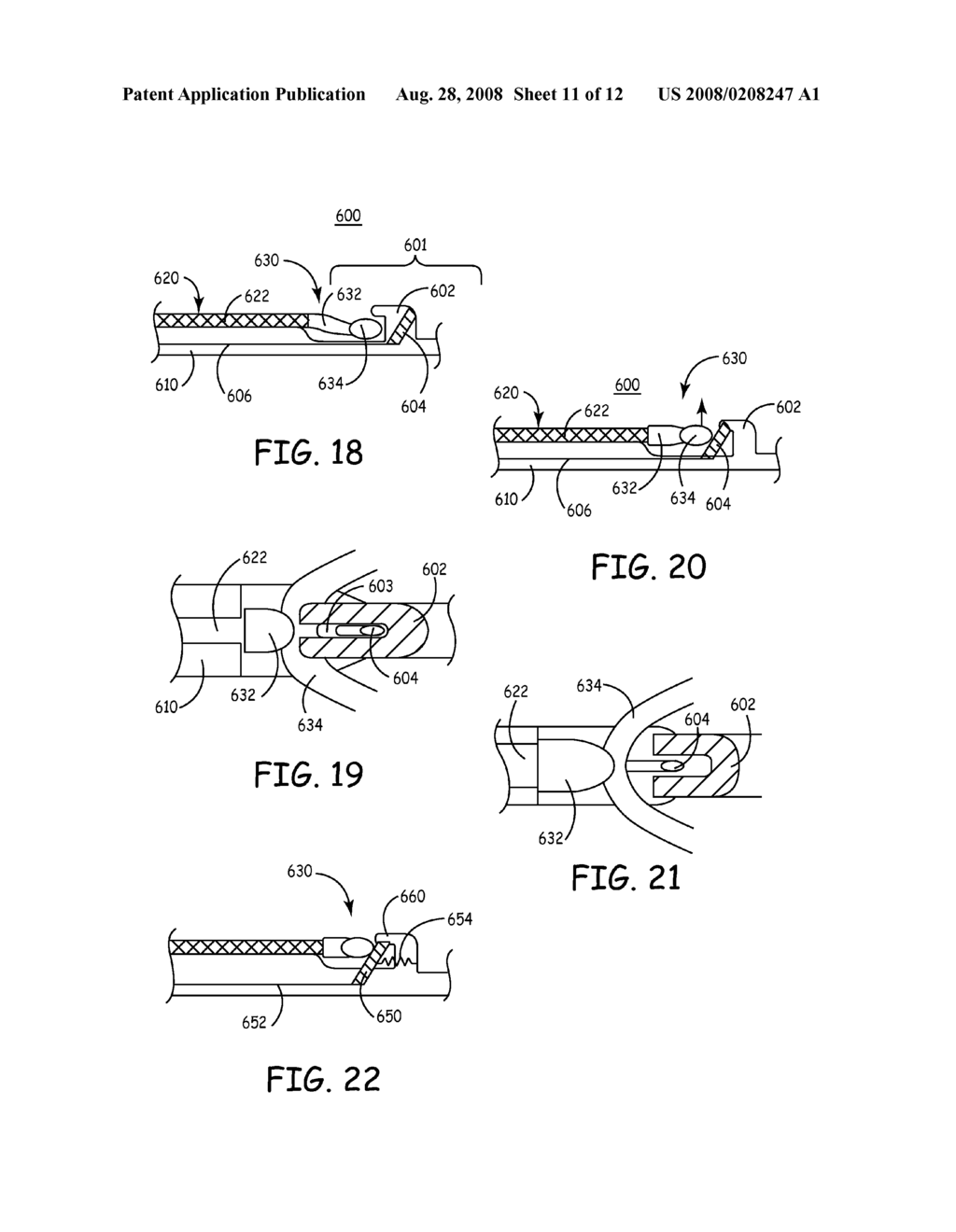 IMPLANTABLE MEDICAL DEVICE SYSTEM WITH FIXATION MEMBER - diagram, schematic, and image 12