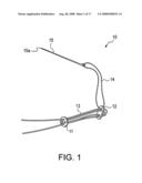 BUNION REPAIR USING SUTURE-BUTTON CONSTRUCT diagram and image