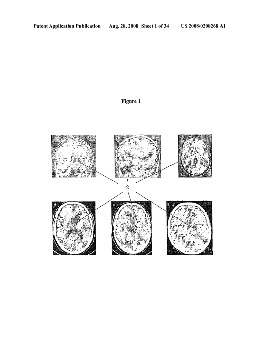 Means for Functional Restoration of a Damaged Nervous System - diagram, schematic, and image 02