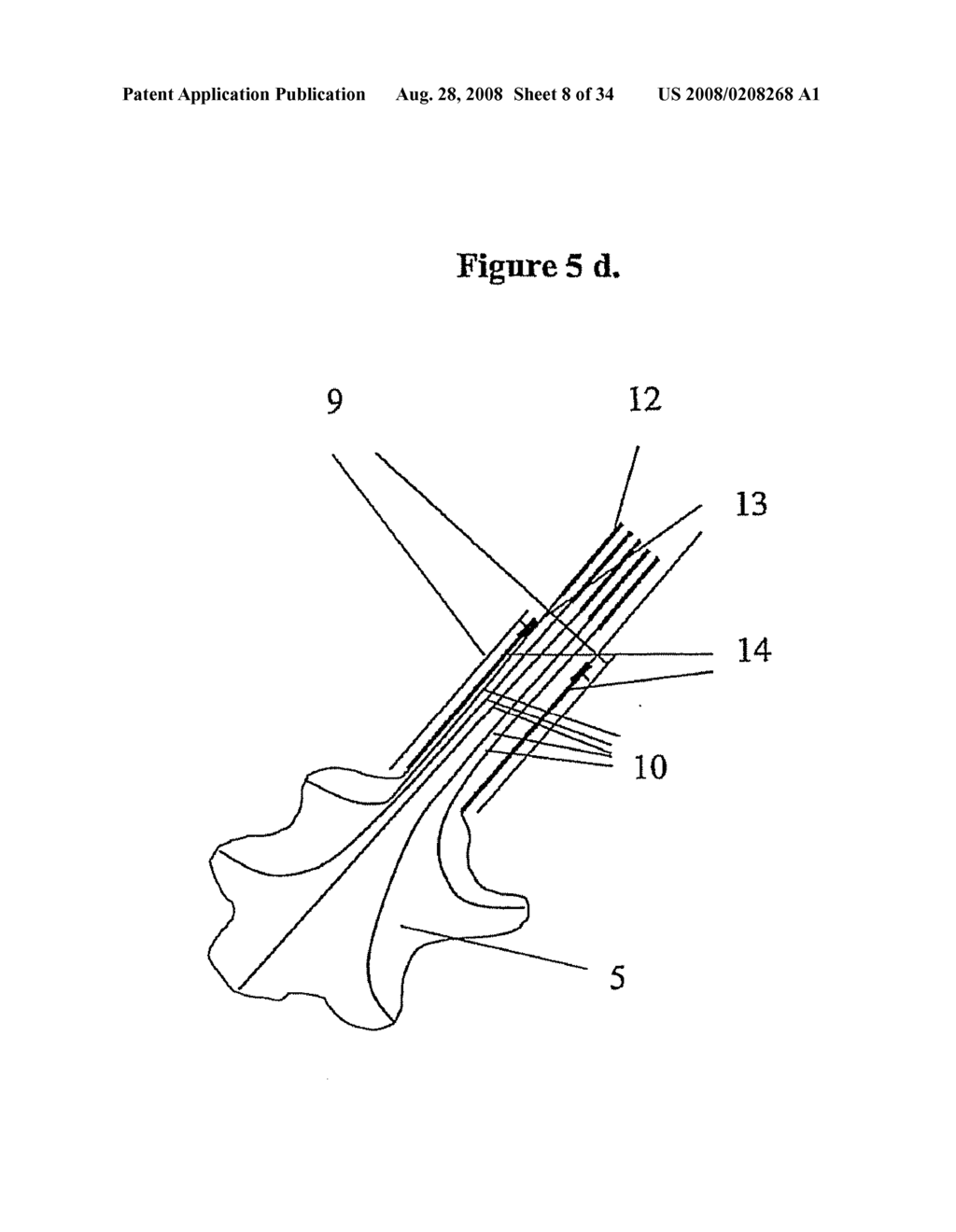 Means for Functional Restoration of a Damaged Nervous System - diagram, schematic, and image 09