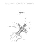 Means for Functional Restoration of a Damaged Nervous System diagram and image