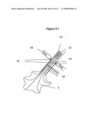 Means for Functional Restoration of a Damaged Nervous System diagram and image