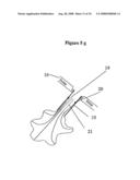 Means for Functional Restoration of a Damaged Nervous System diagram and image