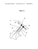 Means for Functional Restoration of a Damaged Nervous System diagram and image