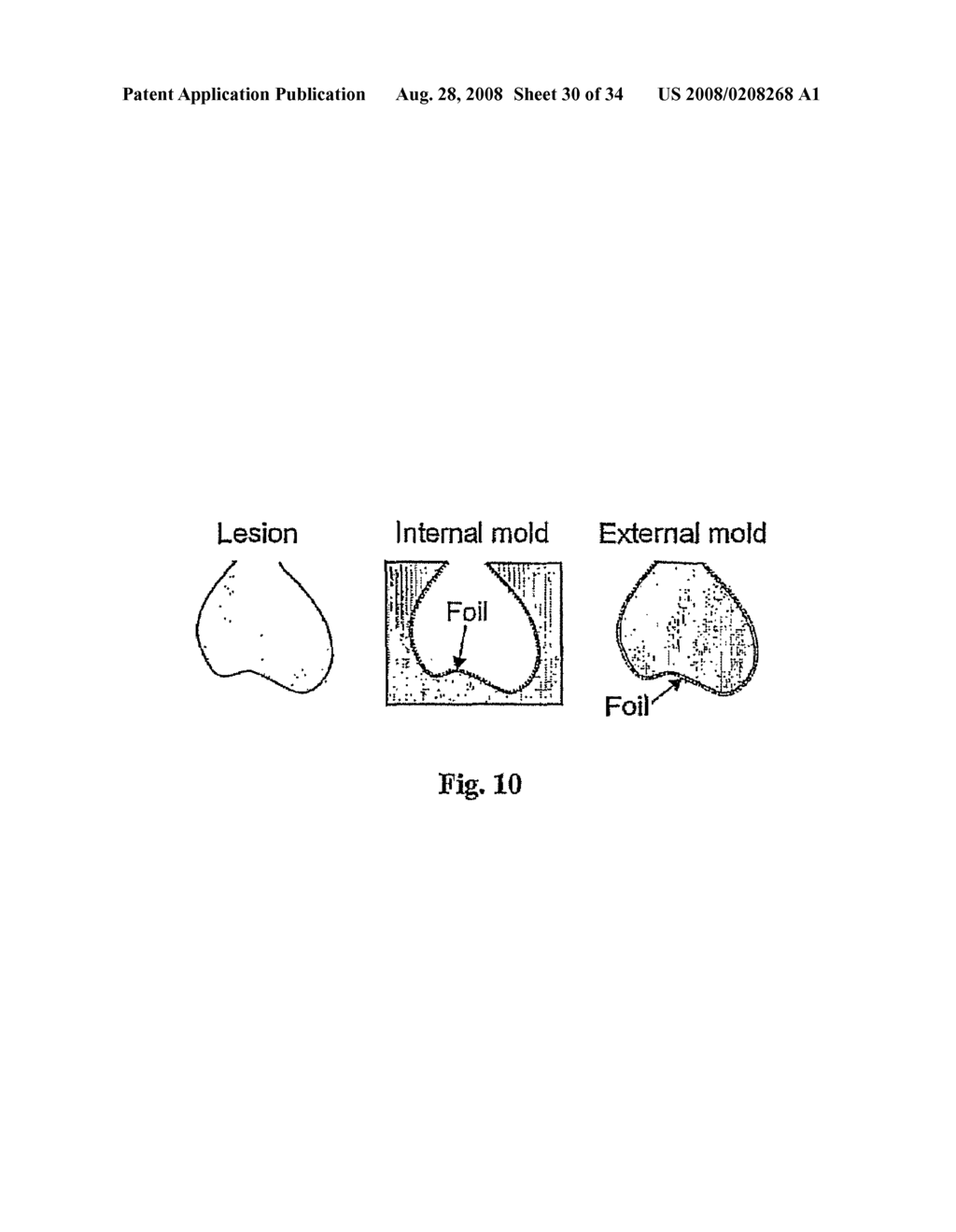 Means for Functional Restoration of a Damaged Nervous System - diagram, schematic, and image 31