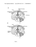 Means for Functional Restoration of a Damaged Nervous System diagram and image