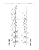 Device and method for biasing and stimulating respiration diagram and image