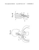 BAROREFLEX ACTIVATION FOR PAIN CONTROL, SEDATION AND SLEEP diagram and image