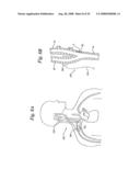 BAROREFLEX ACTIVATION FOR PAIN CONTROL, SEDATION AND SLEEP diagram and image