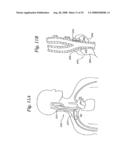 BAROREFLEX ACTIVATION FOR PAIN CONTROL, SEDATION AND SLEEP diagram and image