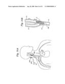 BAROREFLEX ACTIVATION FOR PAIN CONTROL, SEDATION AND SLEEP diagram and image