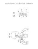 BAROREFLEX ACTIVATION FOR PAIN CONTROL, SEDATION AND SLEEP diagram and image