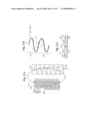 BAROREFLEX ACTIVATION FOR PAIN CONTROL, SEDATION AND SLEEP diagram and image