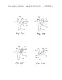 BAROREFLEX ACTIVATION FOR PAIN CONTROL, SEDATION AND SLEEP diagram and image