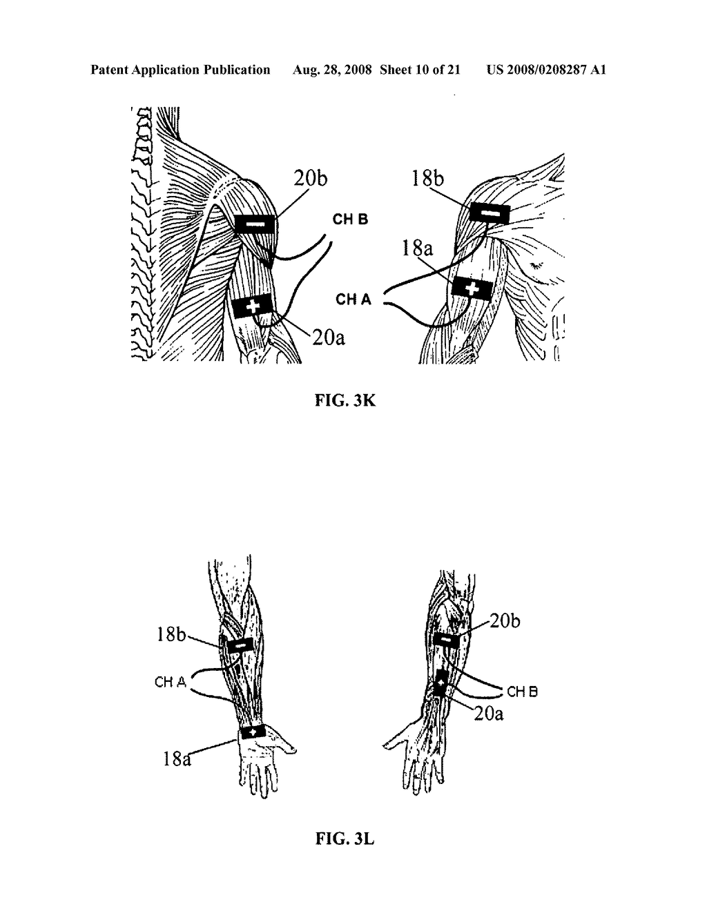 Electrical stimulation device and method for the treatment of neurological disorders - diagram, schematic, and image 11