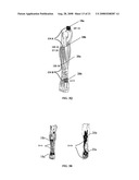 Electrical stimulation device and method for the treatment of neurological disorders diagram and image