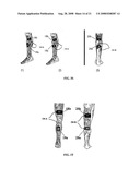 Electrical stimulation device and method for the treatment of neurological disorders diagram and image