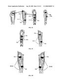 Electrical stimulation device and method for the treatment of neurological disorders diagram and image