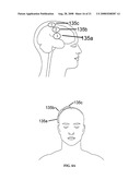 Electrical stimulation device and method for the treatment of neurological disorders diagram and image