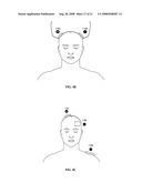 Electrical stimulation device and method for the treatment of neurological disorders diagram and image