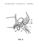 DISINFECTION, DESTRUCTION OF NEOPLASTIC GROWTH, AND STERILIZATION BY DIFFERENTIAL ABSORPTION OF ELECTROMAGNETIC ENERGY diagram and image