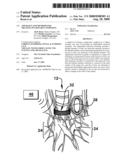 APPARATUS AND METHODS FOR TREATING PULMONARY CONDITIONS diagram and image