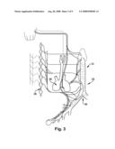 APPARATUS AND METHODS FOR TREATING PULMONARY CONDITIONS diagram and image