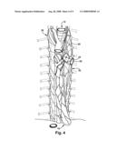 APPARATUS AND METHODS FOR TREATING PULMONARY CONDITIONS diagram and image