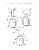 APPARATUS AND METHODS FOR TREATING PULMONARY CONDITIONS diagram and image