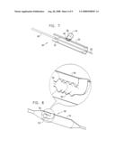 Treatment of Vascular Bifurcations diagram and image