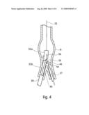 Apparatus and method for implantation of a bifurcated endovascular prosthesis diagram and image