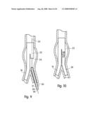 Apparatus and method for implantation of a bifurcated endovascular prosthesis diagram and image