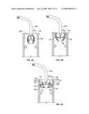 Systems and Methods For Placement of Valve Prosthesis System diagram and image