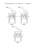 Systems and Methods For Placement of Valve Prosthesis System diagram and image