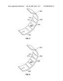 Systems and Methods For Placement of Valve Prosthesis System diagram and image