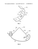 Systems and Methods For Placement of Valve Prosthesis System diagram and image